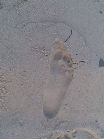 XI.2009r:-)To może być tylko stopa MORSA:-)))